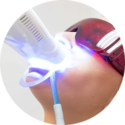 In-House Dental Whitening Procedure